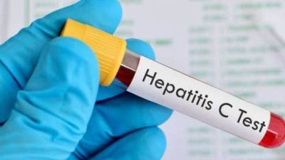 «الصحة» تعلن انخفاض معدل الإصابة السنوي بفيروس سي بمصر.. اعرف النسبة